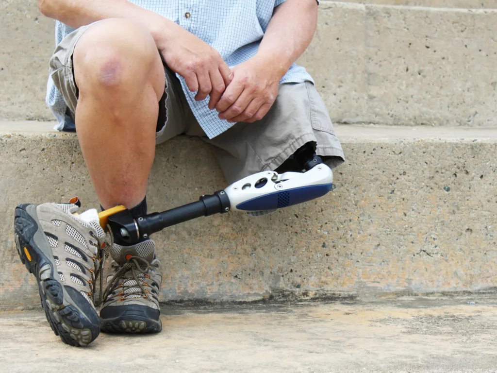 The Newest Health Tech From the VA: Implant Tracking
