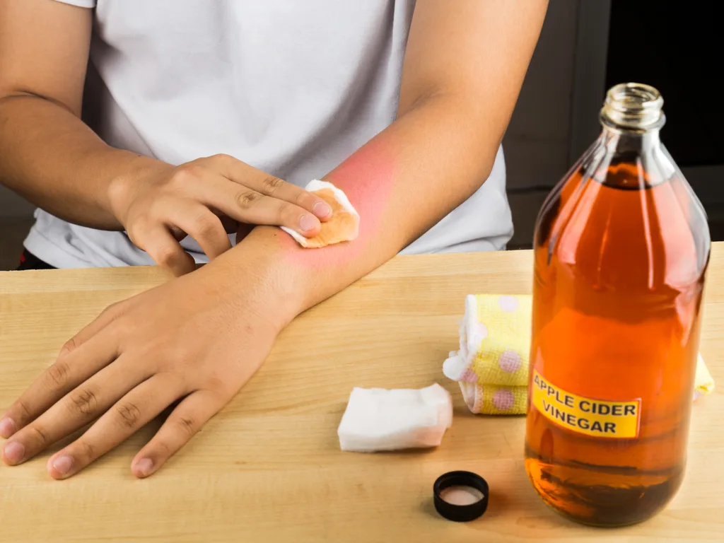 The Health Benefits of Apple Cider Vinegar