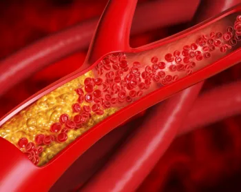 Cholesterol Decoded: What Those Numbers Really Mean for Your Health