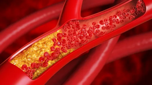 Cholesterol Decoded: What Those Numbers Really Mean for Your Health