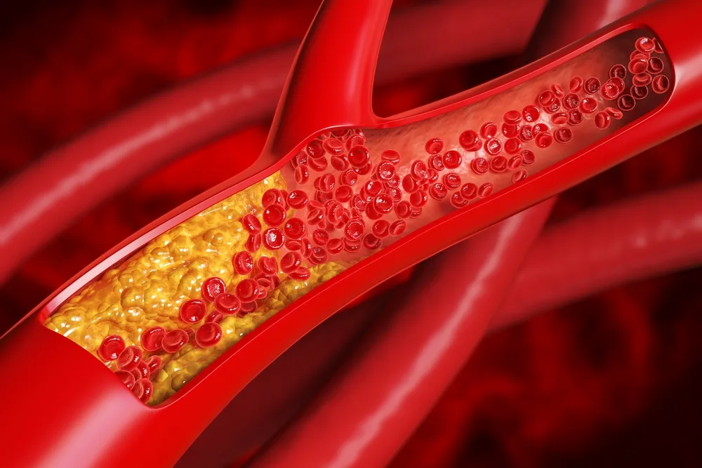 Cholesterol Decoded: What Those Numbers Really Mean for Your Health